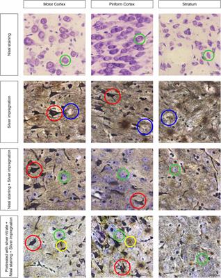 A combined use of silver pretreatment and impregnation with consequent Nissl staining for cortex and striatum architectonics study